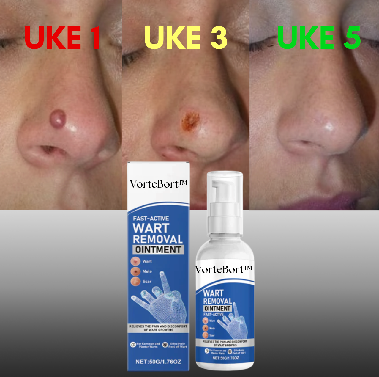 VorteBort™ Få tilbake huden din med en spray